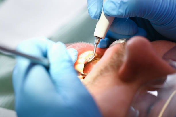 Best Broken or Chipped Tooth Repair in Hampton, TN