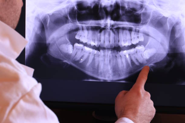 Best Emergency Care for Gum Disease in Hampton, TN